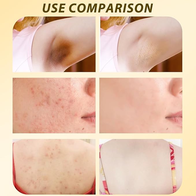 2PCS Bee Venom Comprehensive Cream,Bee Venom Skin Care Cream,Advanced Bee Venom Therapy Cream for All Skin Types