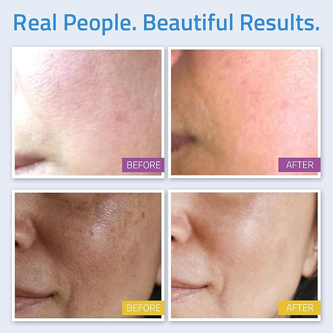 YEOUTH Skin Care Set: Retinol Serum