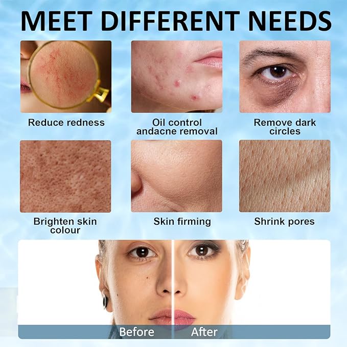 Ice Face Roller, Joyeee Silicone Ice