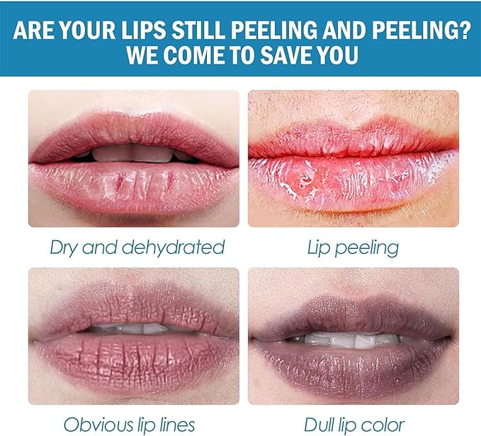 2pcs Lip Lightening for Dark Lips