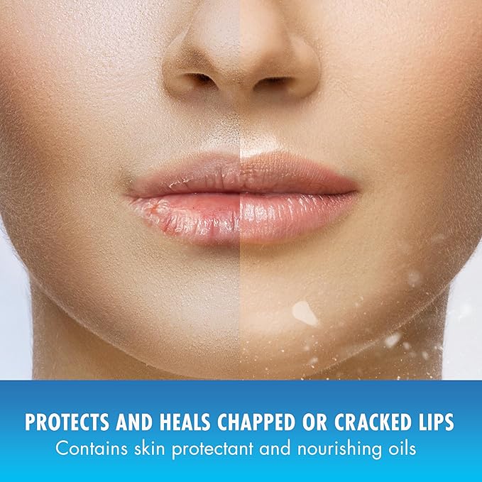 Natural Ice Original SPF 15 Medicated